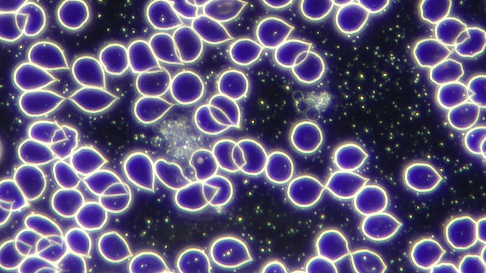 Raw darkfield microscopy image of live blood cells